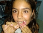 Se me cae un colmillo