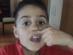 Se me cae otro diente