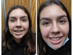 Me quitan el aparato