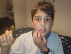 Pierdo mi primera muela