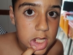 Otro colmillo menos
