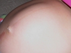 bulto