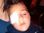 20170318 A la Quiron por un ojo