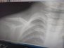 20170531 Traumatología