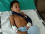 20180730 Operación y día en el hospital